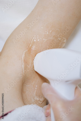 shaving arms with laser. beauty treatment