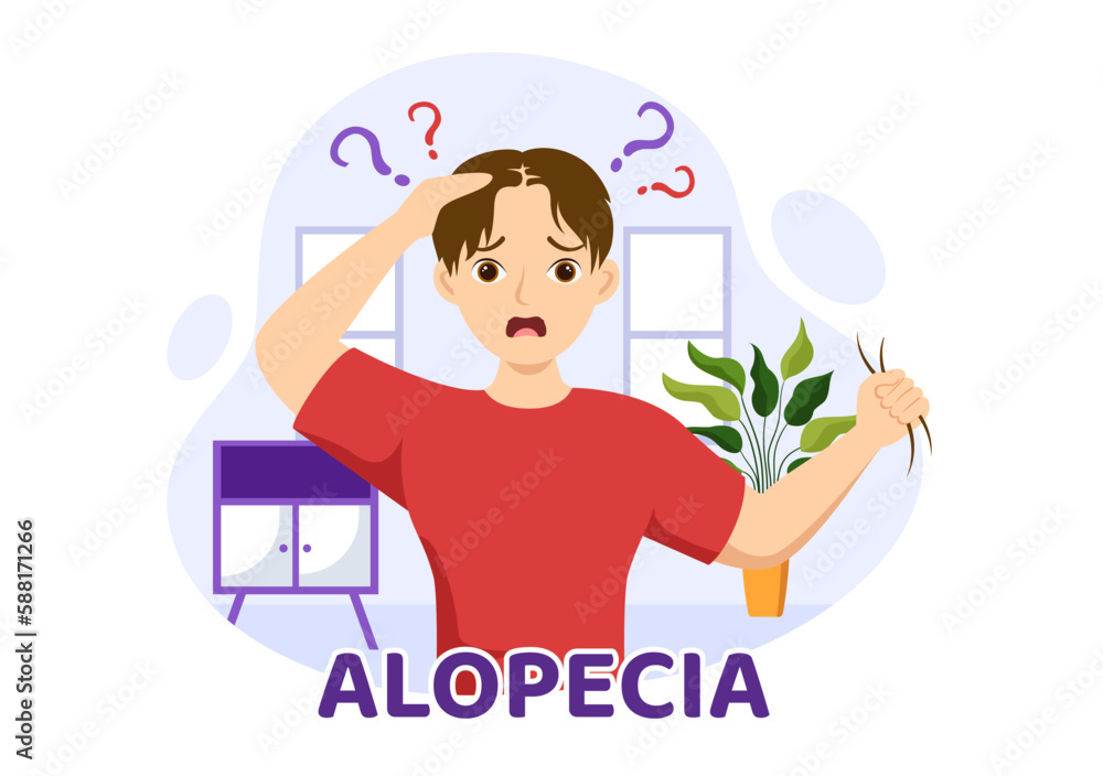 Alopecia Illustration with Hair Loss Autoimmune Medical Disease and Baldness in Healthcare Flat Cartoon Hand Drawn Banner or Landing Page Templates