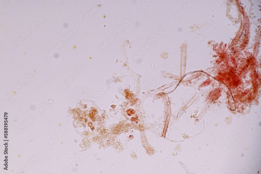 Obraz premium Host cells with spores (mold) are inside wood under the microscope for education. 