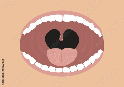 Opened Mouth concept with tonsils shown. Editable Clip art.