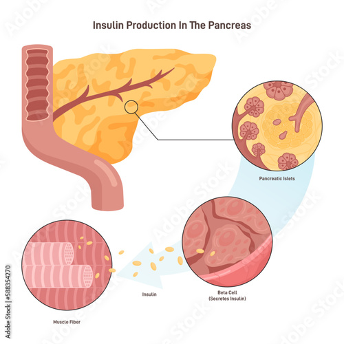 Insulin production mechanism. Pancreas b-cells release insulin. Metabolic