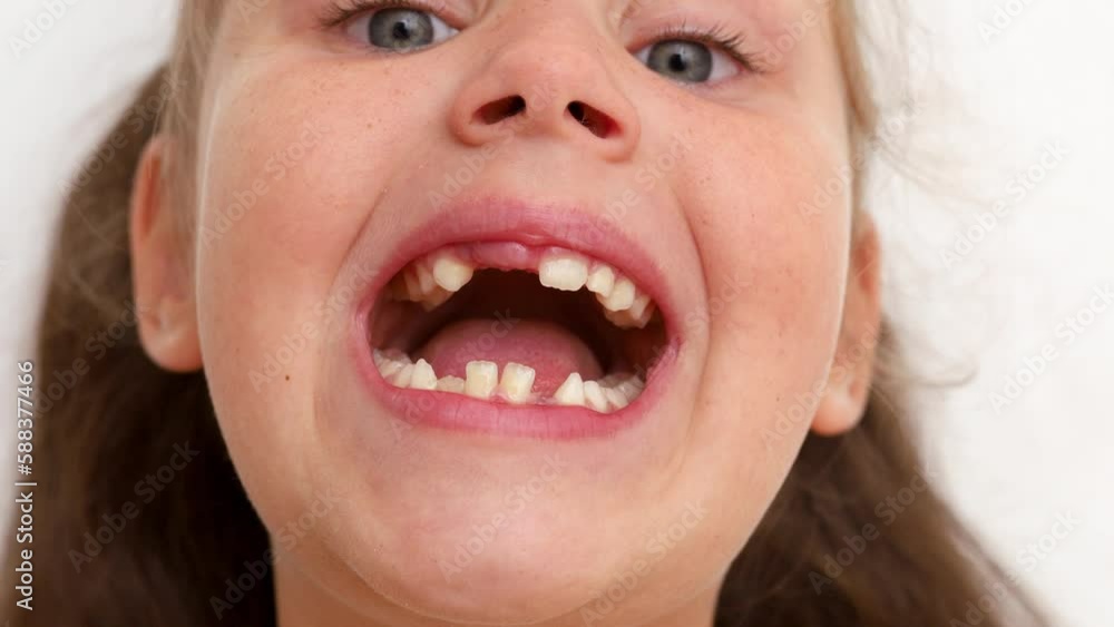 Adorable, cute, playful little blond girl with blue eyes smiling wide and show open toothless mouth from different sides on white isolated background. Stomatology appointment, dentist health check Adorable, cute, playful little blond girl with blue eyes smiling wide and show open toothless mouth from different sides on white isolated background. Stomatology appointment, dentist health check