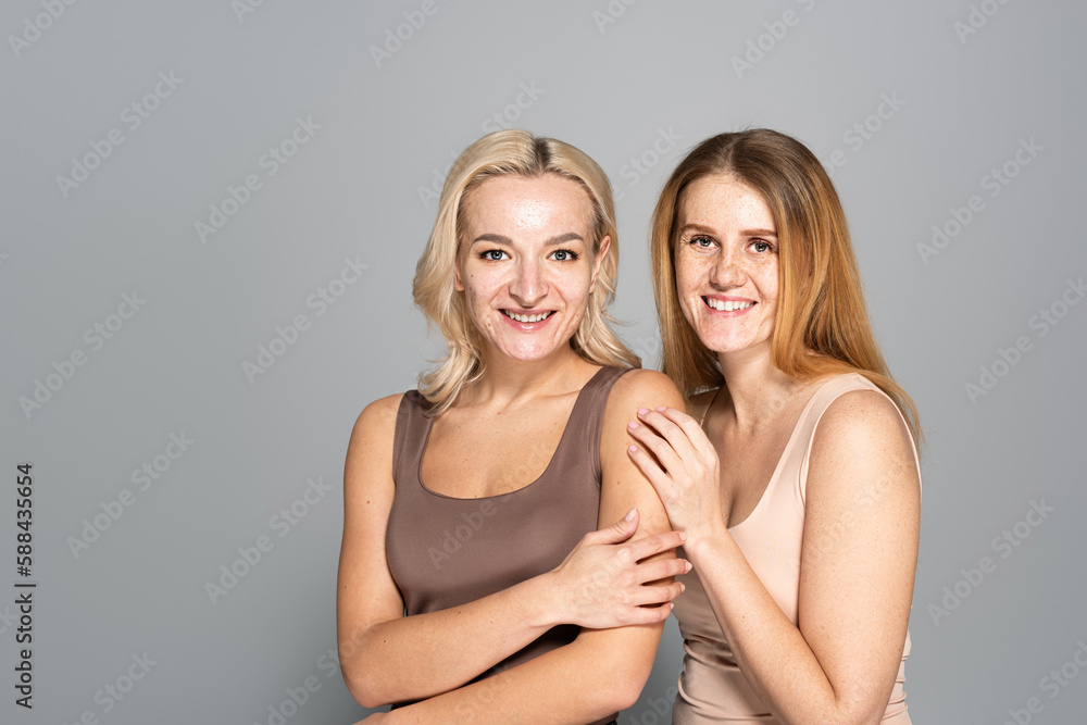 Carefree women with skin issues looking at camera on grey background. Carefree women with skin issues looking at camera on grey background.