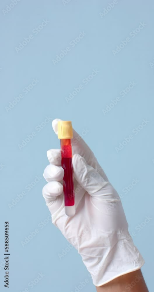 Vertical video of hand wearing medical glove holding blood sample on blue background, slow motion Vertical video of hand wearing medical glove holding blood sample on blue background, slow motion