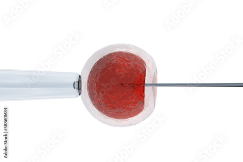 Illustration of intracytoplasmic sperm injection