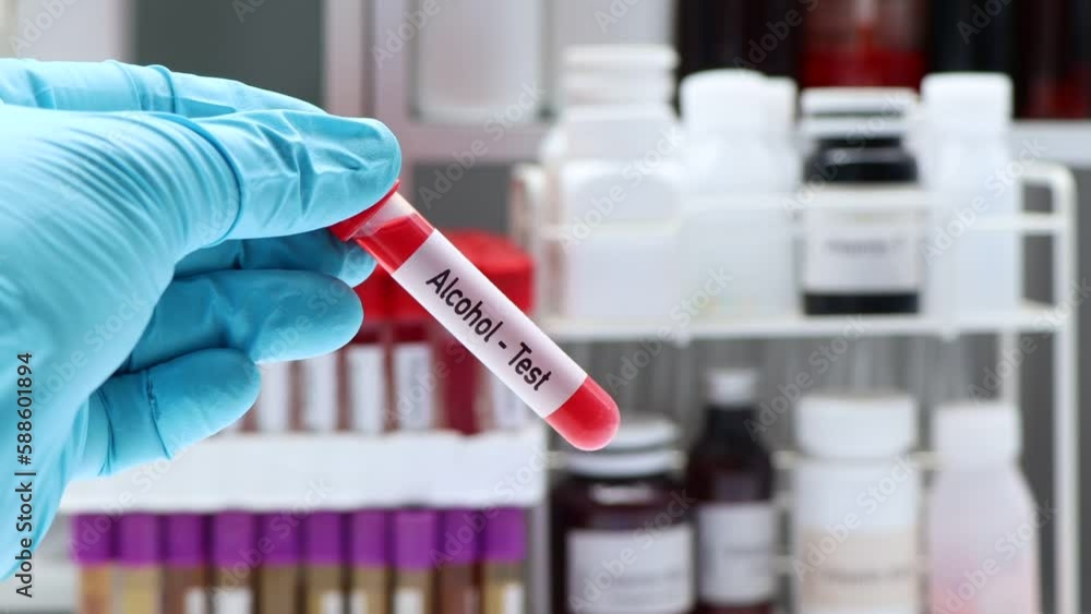 Alcohol test to look for abnormalities from blood, blood sample to analyze in the laboratory, blood in test tube Alcohol test to look for abnormalities from blood, blood sample to analyze in the laboratory, blood in test tube