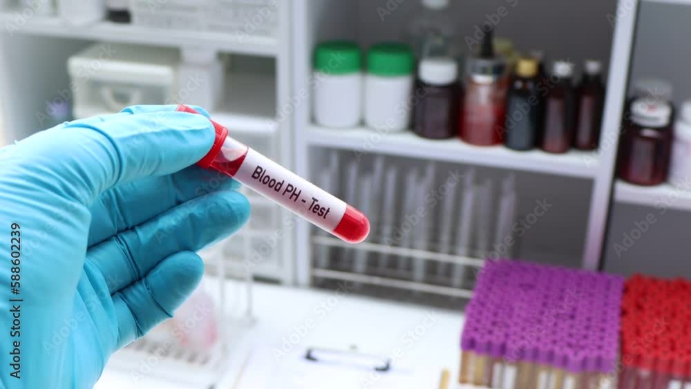 Blood pH test to look for abnormalities from blood, blood sample to analyze in the laboratory, blood in test tube Blood pH test to look for abnormalities from blood, blood sample to analyze in the laboratory, blood in test tube
