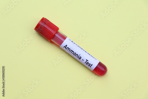Ammonia test to look for abnormalities from blood