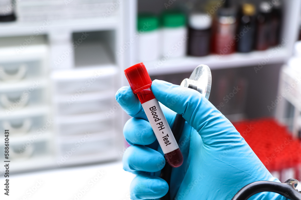 Blood pH test to look for abnormalities from blood Stock Photo Adobe