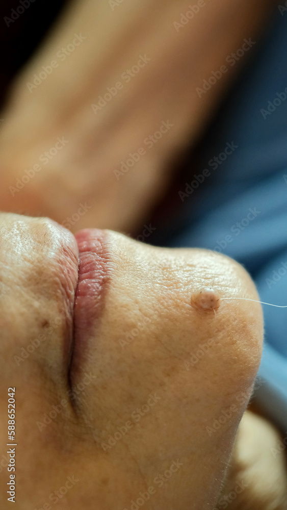 A mole with only one hair growing on the face. A mole with only one hair growing on the face.