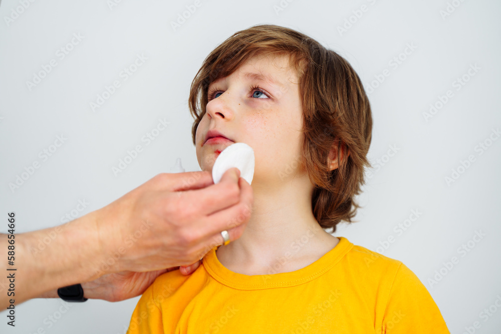Dad doctor father treats bruised wound on his son school boy kid face. Man cleans addresses the sore wound on child face on white background with copy space for text. Dad doctor father treats bruised wound on his son school boy kid face. Man cleans addresses the sore wound on child face on white background with copy space for text.