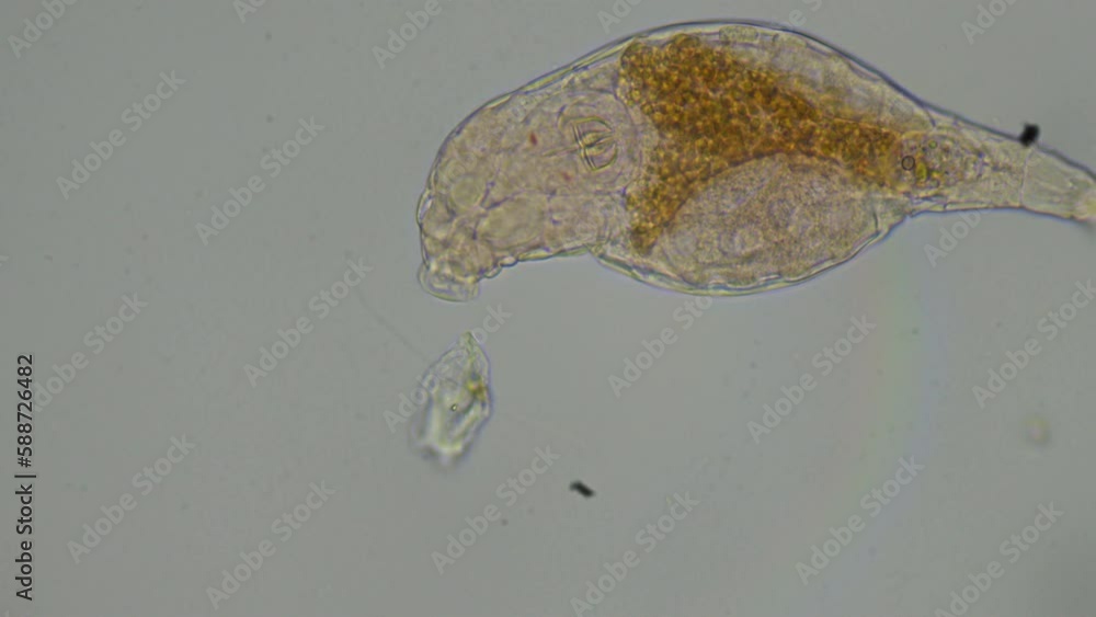 Video through the microscopic world of Bdelloid Rotifers. You'll see ...
