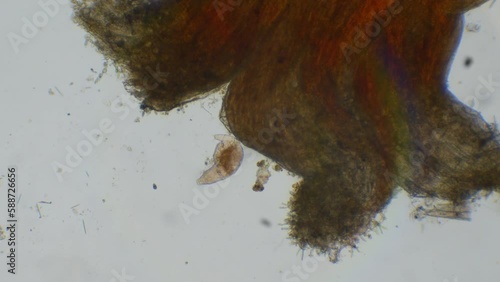Microscopic video of Bdelloid Rotifers, tiny aquatic animals found in freshwater habitats all over the world. The video showcases the beauty and complexity of these microorganisms. photo