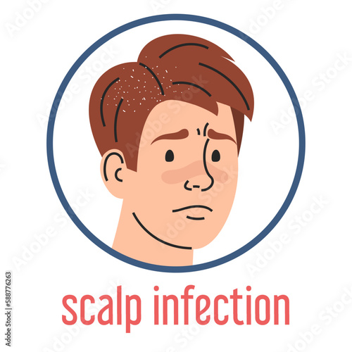 Scalp infection vector isolated. Medical condition, dermatology disease. Sad man with dandruff on hair.