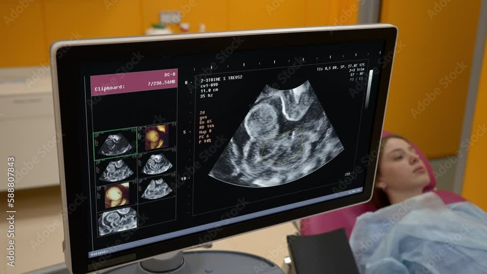 Stockvideo Looking at the screen during the scanning checkup procedure