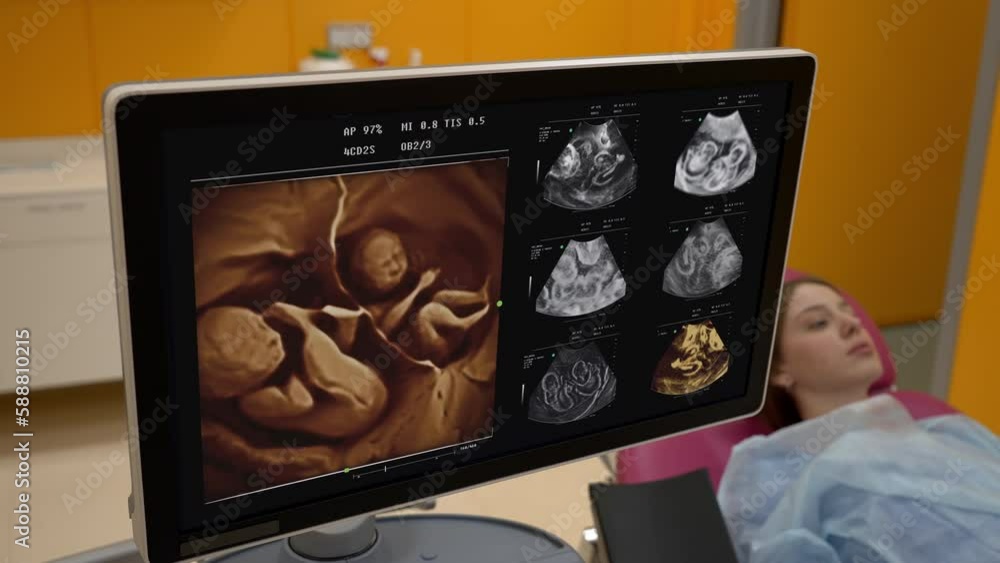 Vidéo Stock Scanning the pregnant woman patient at the maternity