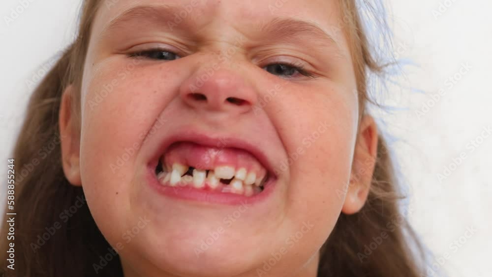 Animated shot of small blond little girl growling and grinning at the camera with toothless mouth on white studio background. Wonky, crooked milk teeth and bad bite. Need hygiene and dental checking. Animated shot of small blond little girl growling and grinning at the camera with toothless mouth on white studio background. Wonky, crooked milk teeth and bad bite. Need hygiene and dental checking.