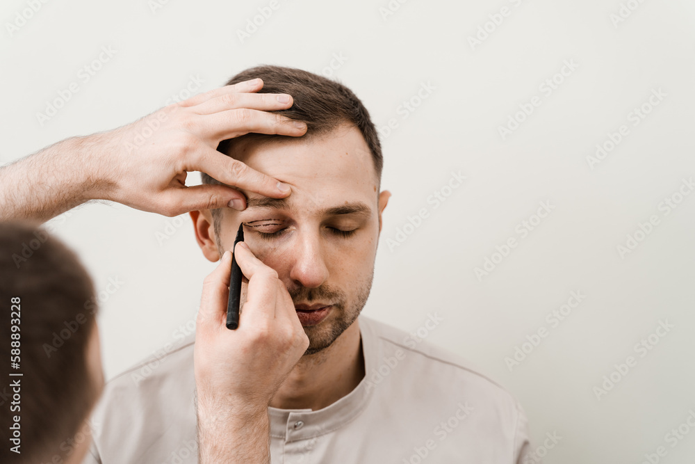 Blepharoplasty for man markup on the face before plastic surgery operation for modifying the eye region in medical clinic. Blepharoplasty for man markup on the face before plastic surgery operation for modifying the eye region in medical clinic.