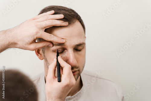 Male blepharoplasty for man markup. Plastic surgeon draws markings on the eyelid before plastic surgery operation for modifying the eye region in medical clinic. photo