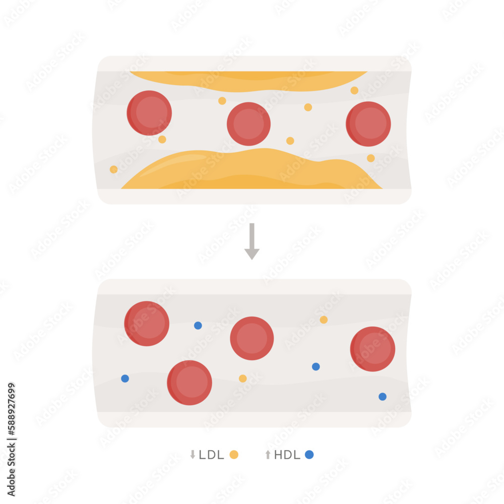 Infografía función Omega 9 en arterias y venas. Aumenta el colesterol