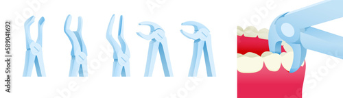Dental Extracting Forceps Set. Cropped White Teeth with Extracting Forceps Close Up. Modern Flat Vector Illustration.