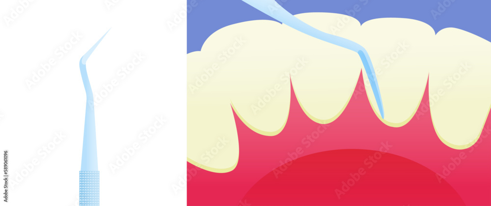 Dental Gum Cleaner Oral Tool Close Up. Cropped White Teeth Outer Layer. Modern Flat Vector Illustration. Dental Gum Cleaner Oral Tool Close Up. Cropped White Teeth Outer Layer. Modern Flat Vector Illustration.