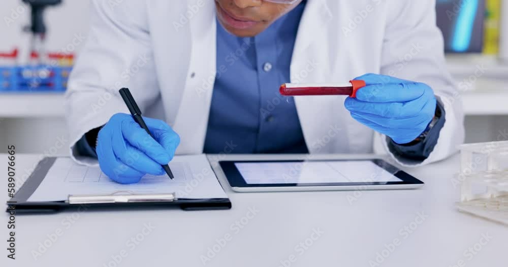 Hands, blood and writing in a laboratory for science, research and innovation in the medical industry. Healthcare, dna and sample with a scientist working in a lab for development or breakthrough Hands, blood and writing in a laboratory for science, research and innovation in the medical industry. Healthcare, dna and sample with a scientist working in a lab for development or breakthrough