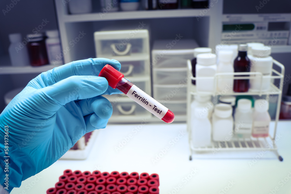 ferritin test to look for abnormalities from blood Stock Photo | Adobe ...
