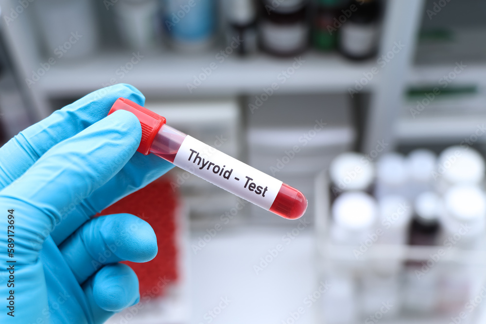 Fototapeta premium Thyroid test to look for abnormalities from blood