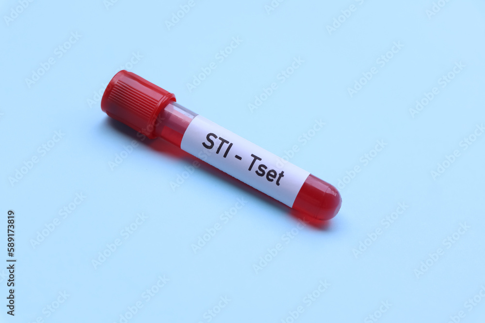 STI test to look for abnormalities from blood STI test to look for abnormalities from blood