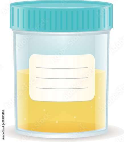 Specimen cup with urine realistic vector illustration isolated on white