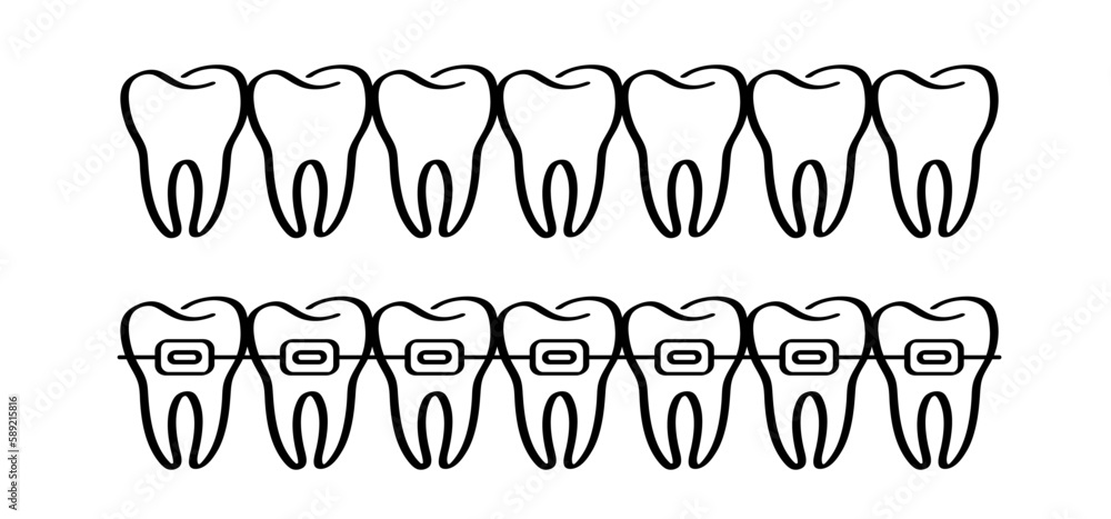 Cartoon healthy, tooth with gums. Molar pattern. Vector drawing ...