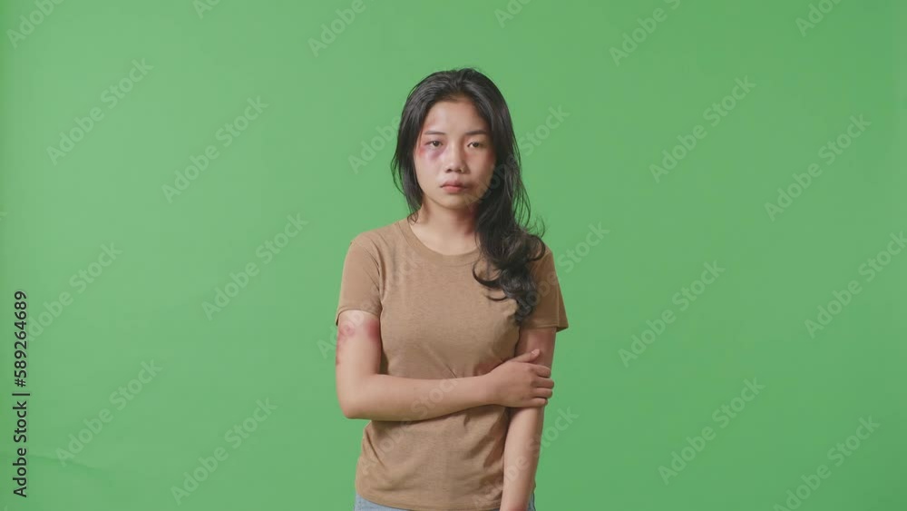 Young Asian Woman With Bruise On Face And Arms Hugging Herself Being Hurt From Violence While Standing On Green Screen Background In The Studio
Young Asian Woman With Bruise On Face And Arms Hugging Herself Being Hurt From Violence While Standing On Green Screen Background In The Studio