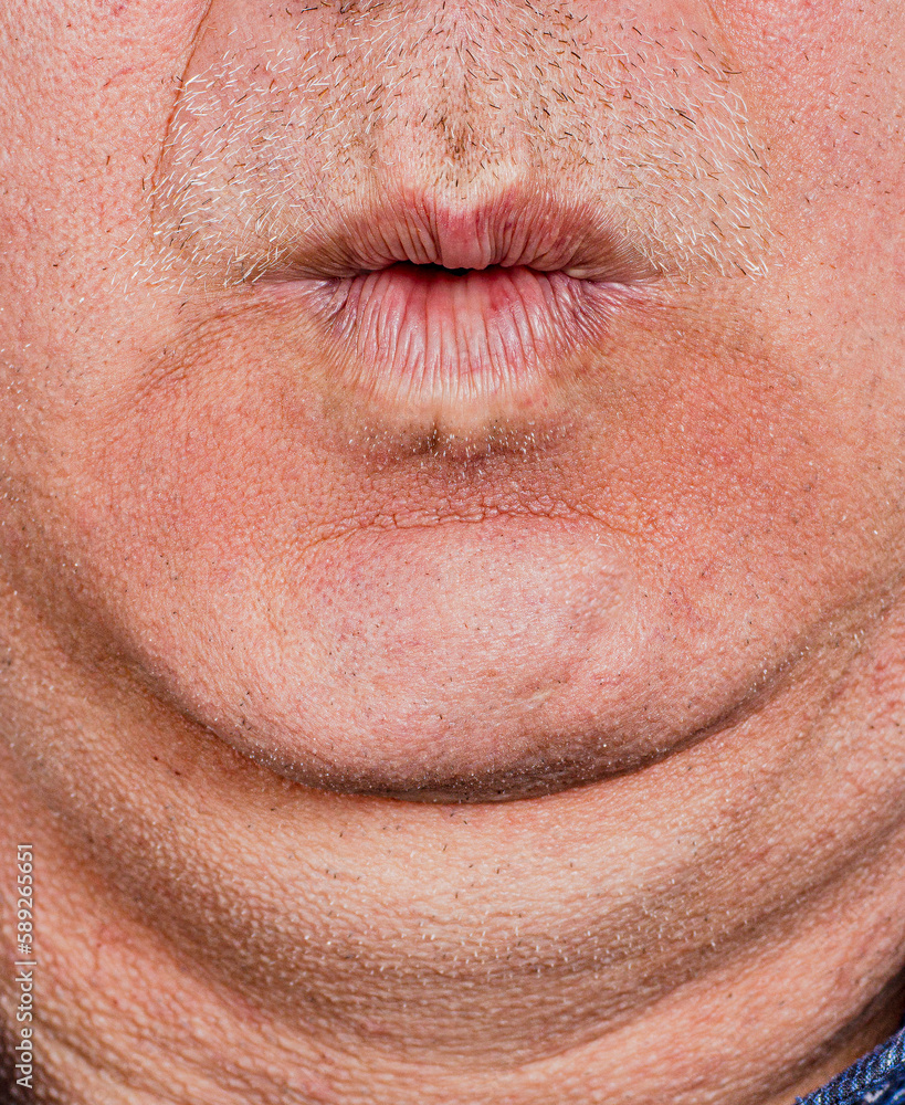 close up of person double chin close up of person double chin