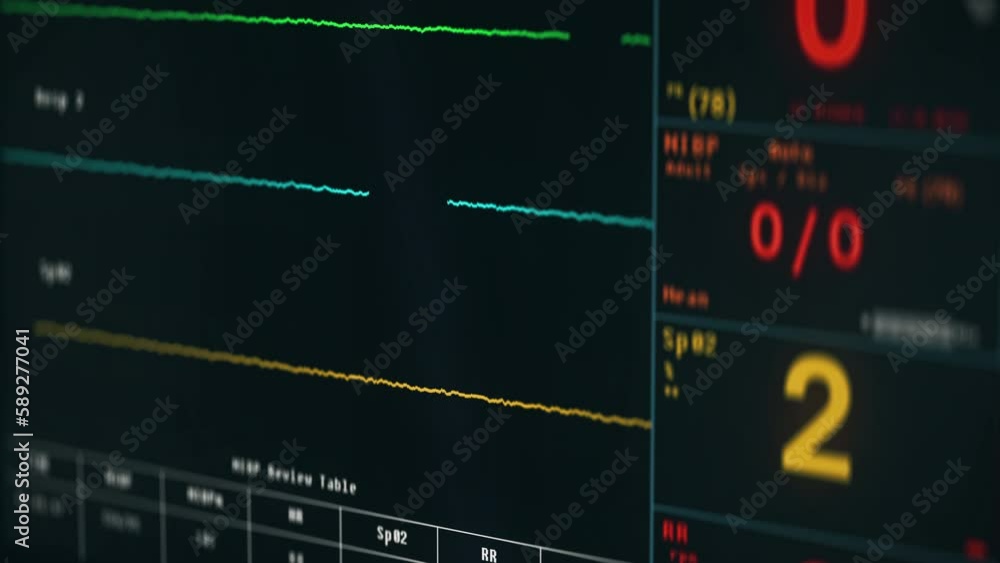 Healthcare Monitoring Equipment Alerts Doctors Of Patient's Decreasing