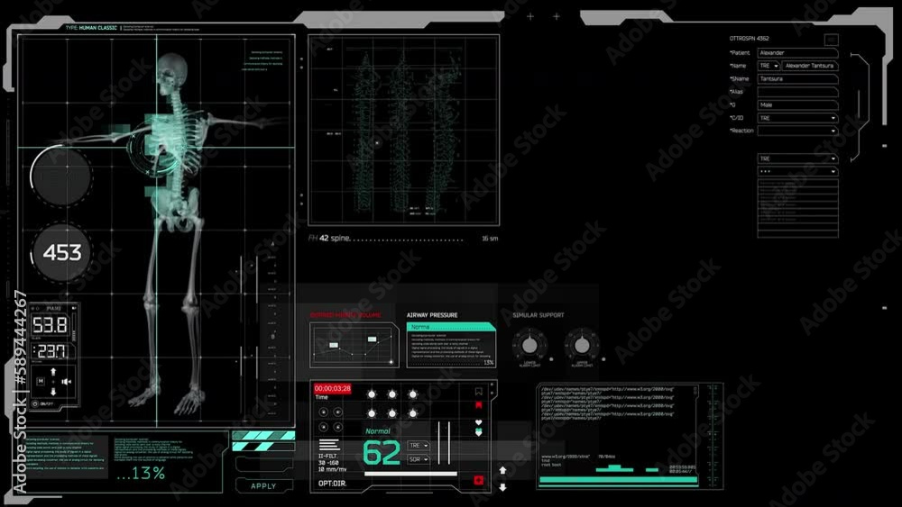 The hud interface of the futuristic medical program is a digital control panel with digital visualization of magnetic resonance imaging (MRI) capable of examining all parts of the spine and joints wit
