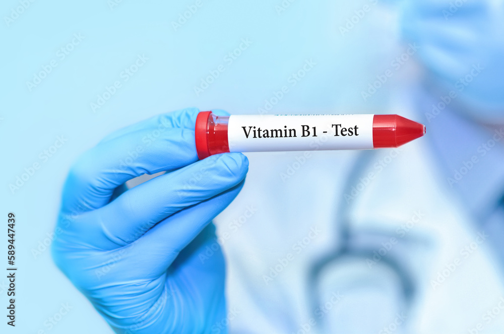 Obraz premium Doctor holding a test blood sample tube with Vitamin B1 test.