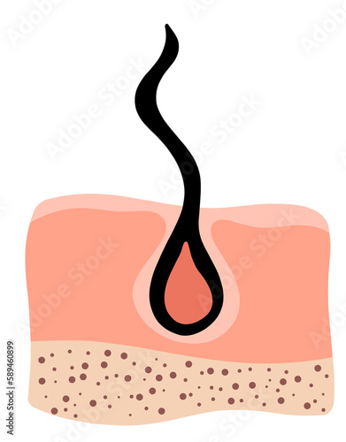 Normal hair growth. Inflammation, skin problems. Anatomy infographics of hair. Flat illustration isolated on the white background.