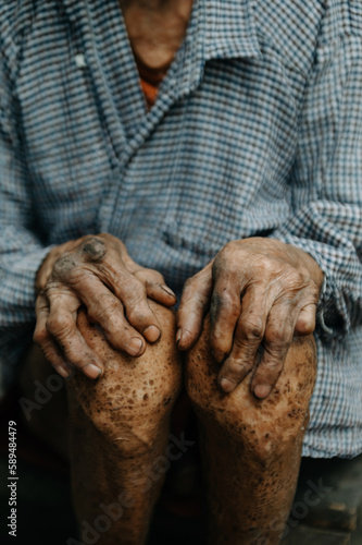 Obraz na płótnie Close up of male wrinkled hands, old man is wearing  skin disease and anxiety Copy space