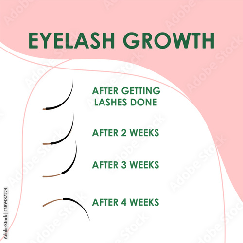 Eyelash extension. Eyelash growth. Improper eyelash extensions. Consequences of eyelash extensions.