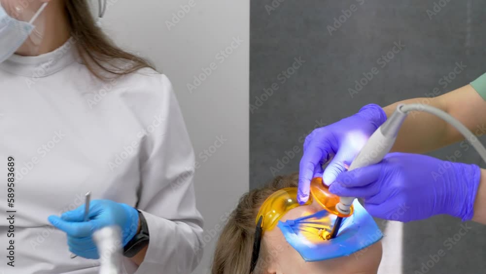 Vidéo Stock Tooth restoration with filling and polymerization lamp