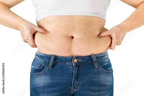 Overweight women weight loss people female large © BillionPhotos.com