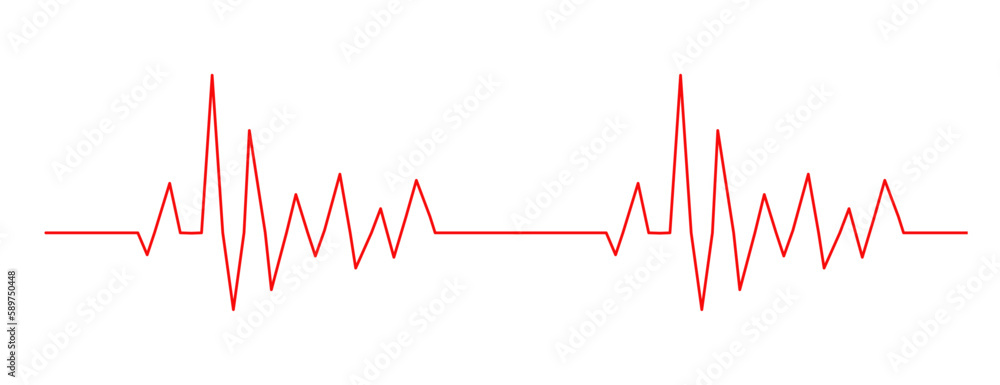 heart beat  electrocardiogram on the monitor