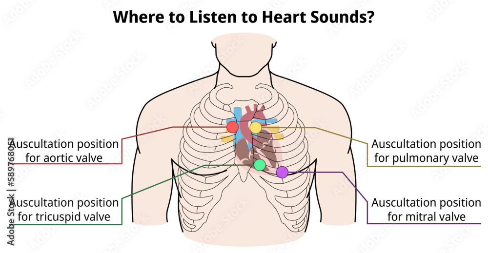 Fototapeta premium Where to listen to heart sounds? - Auscultation Position of Heart Valve - Vector Medical Illustration