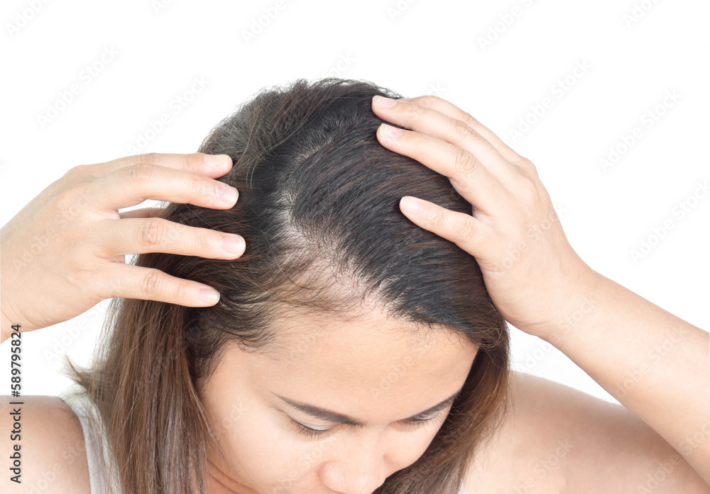 Closeup woman hand itchy scalp, for health care shampoo and beauty product concept Hair care concept Closeup woman hand itchy scalp, for health care shampoo and beauty product concept Hair care concept