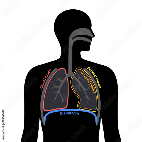 Pleura anatomical poster
