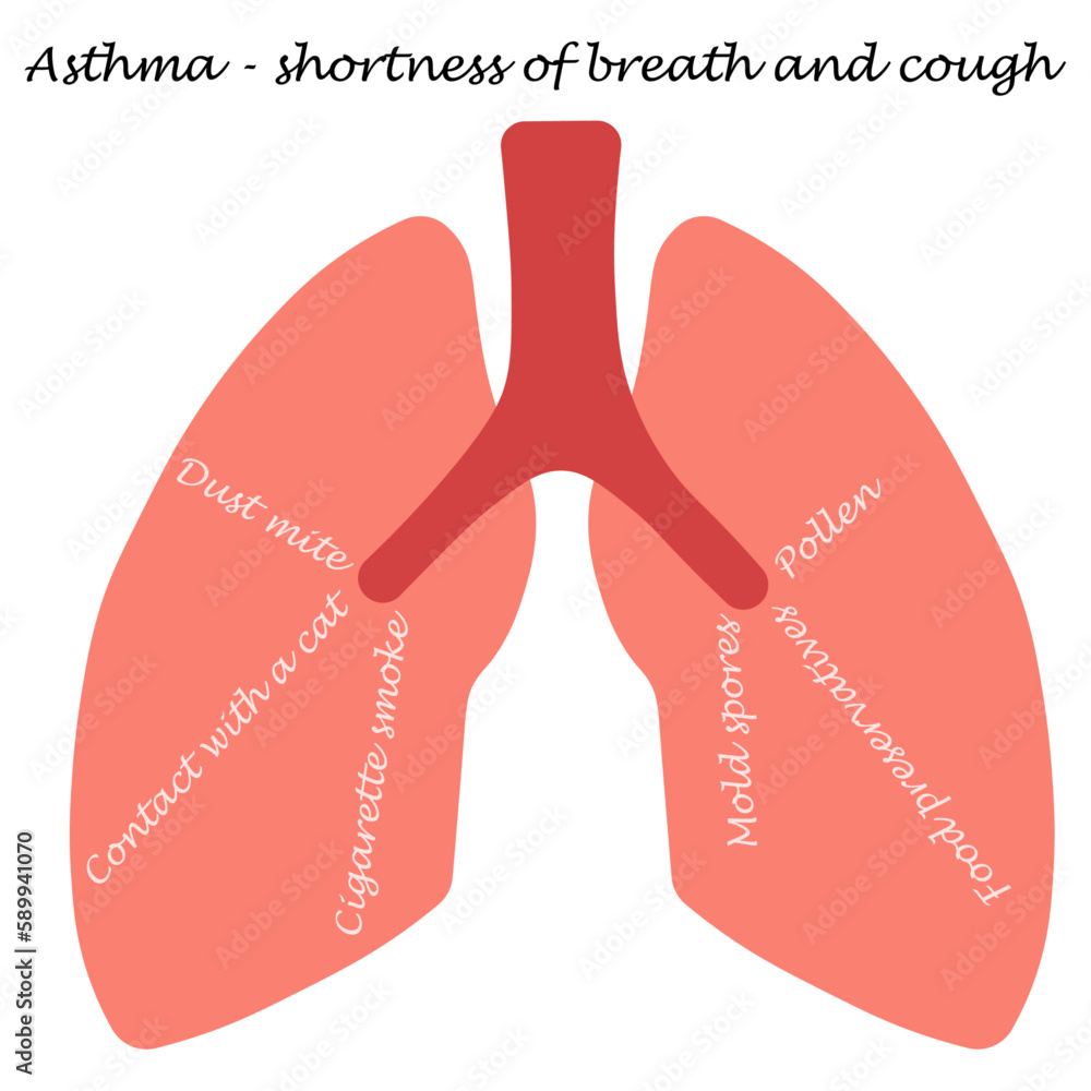 Human lungs. Text about Asthma disease. White background. Human lungs. Text about Asthma disease. White background.