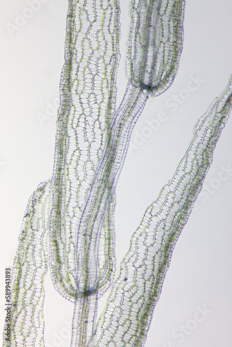 Microscopic view of peat moss (Sphagnum) detail. Gentian violet stain. Brightfield illumination.