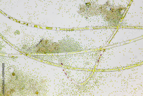 Microscopic view of various species of freshwater algae. Brightfield illumination.
