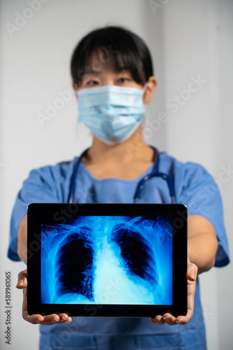 Female doctor holding a screen with x-ray of lungs.